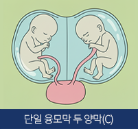 두 용모막 쌍둥이(C)이미지