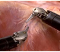 다빈치 Xi 로봇 수술 특징